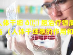 人体干细 🦅 胞治疗银屑病 🐧 （人体干细胞的作用和功效）